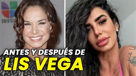 lis vega antes|LIS VEGA, Antes y después de todo